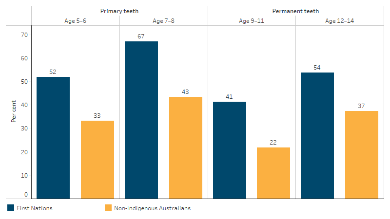 Percentage of children with experience of decayed, missing or filled tooth surfaces in primary (baby teeth) or permanent teeth, by Indigenous status and age group This bar chart shows that First Nations children in every age group from 5–6 to 12–14 had higher proportions of decayed, missing or filled tooth surfaces (DMFS) than non-Indigenous children.