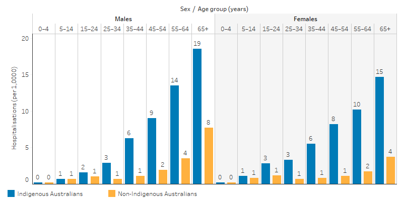 This bar chart shows that the hospitalisation rate for diabetes increased with age for Indigenous and non-Indigenous Australians, for both males and females. For Indigenous Australians, rates were highest for those aged 65 and over, at 19 per 1,000 for males and 15 per 1,000 for females. For non-Indigenous Australians, rates were highest for those aged 65 and over, with rates 8 per 1,000 for males and 4 per 1,000 for females.