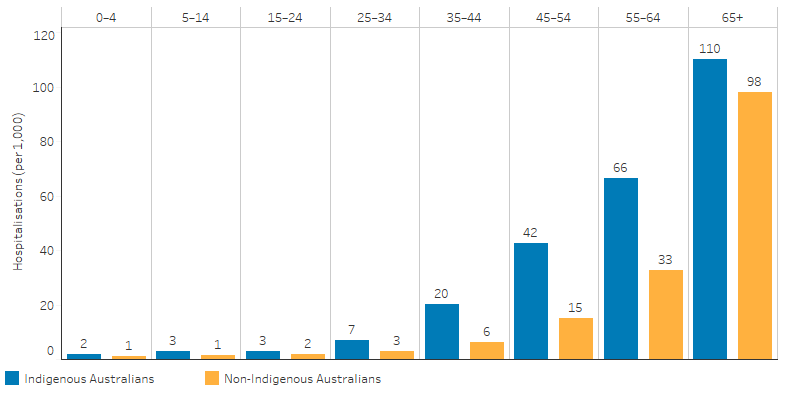 This bar chart shows that hospitalisation rates for circulatory diseases increased with age for Indigenous and non-Indigenous Australians and that rates were higher for Indigenous Australians in all age groups. For Indigenous Australians aged 0–4 the rate was 2 hospitalisations per 1,000 population and for those aged 65 and over the rate was 110 per 1,000. For non-Indigenous Australians aged 0-4 the rate was 1 per 1,000 and for those aged 65 and over the rate was 98 per 1,000. 